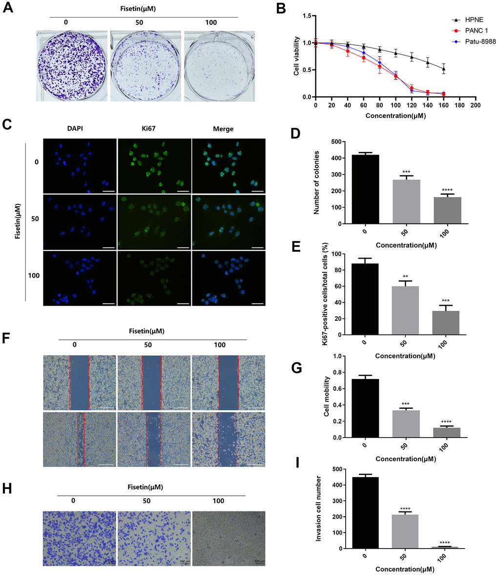 Fisetin dampens the proliferation, migration along with infiltration of Patu-8988 cells. (A) Colony formation assessment of Patu-8988 cells inoculated with 0,50 and 100 μM fisetin. (B) CCK-8 assay of the HPNE, PANC-1 and Patu-8988 cells inoculated with 160 μM, 140 μM, 120 μM, 100 μM, 80 μM, 60 μM, 40 μM, and 20 μM of Fisetin or an equivalent DMEM medium volume for 48 h. (C) Ki67 Immunofluorescence staining of Patu-8988 cells inoculated with 0,50 and 100 μM fisetin for 24h. Bar = 50μm. (D) Histogram representing the number of colonies in each group. (E) Histogram illustrating Ki67 positive rate of Patu-8988 cells in every group. (F) Wound healing assays of Patu-8988 cells inoculated with 0, 50 and 100μM fisetin for 24 h. Bar = 500μm. (G) Histogram illustrating cell mobility of Patu-8988 cells in every group. (H) Transwell assays of Patu-8988 cells inoculated with 0, 50 and 100μM fisetin for 24 h. (I) Histogram illustrating the invasion cell number in every group. All experiments were replicated thrice, and data are given as means±SD.*p
