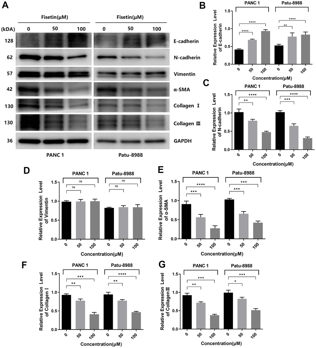 Fisetin inhibits the expression of EMT-related proteins in PANC-1, as well as Patu-8988 cells. (A) Western blot assessment of EMT-linked proteins in Patu-8988, as well as PANC-1 cells inoculated with 0, 50 and 100μM fisetin for 24 h. (B) Histogram illustrating E-cadherin protein contents. (C) Histogram illustrating N-cadherin protein contents. (D) Histogram illustrating Vimentin protein contents. (E) Histogram illustrating alpha-SMA protein contents. (F) Histogram illustrating Collagen I protein contents. (G) Histogram illustrating Collagen III protein contents. All assays were replicated thrice, and data are given as means±SD.*p