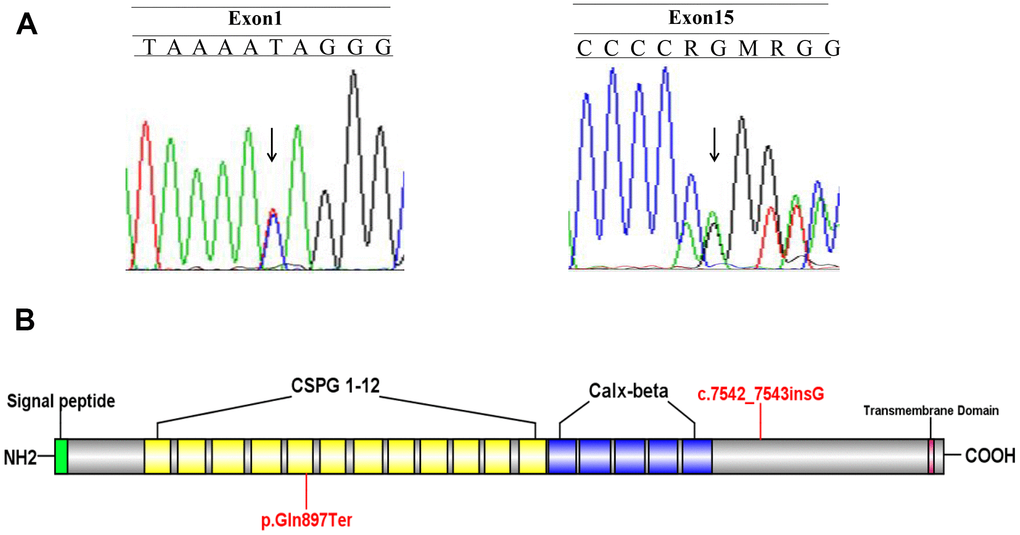 Identify the disease-causing mutation in the Fraser syndrome family. (A) Two mutations c.7542