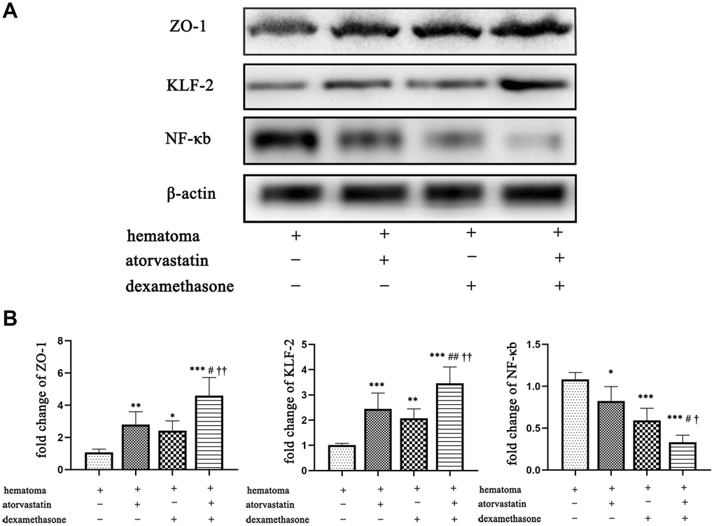 Changes in ZO-1, KLF-2 and NF-κb expression in the capsule of the chronic subdural hematoma model in different treatment groups. (A) Changes in ZO-1, KLF-2 and NF-κb expression in the hematoma capsule in the different treatment groups after modeling. (B) The ZO-1, KLF-2 and NF-κb mRNA expression in the hematoma capsule detected by PCR in the different treatment groups after modeling. * p 