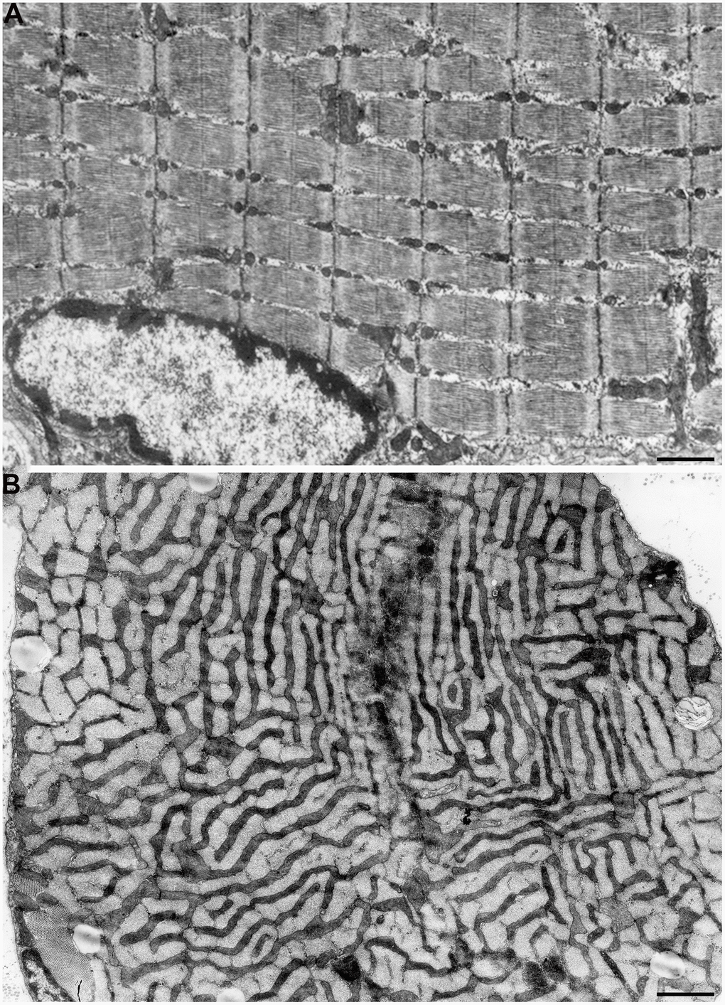 Mitochondrial reticulum in diaphragm of a two-month-old rat. (A) Longitudinal section. (B) Cross section through isotropic region. (from Bakeeva et al. [40]).