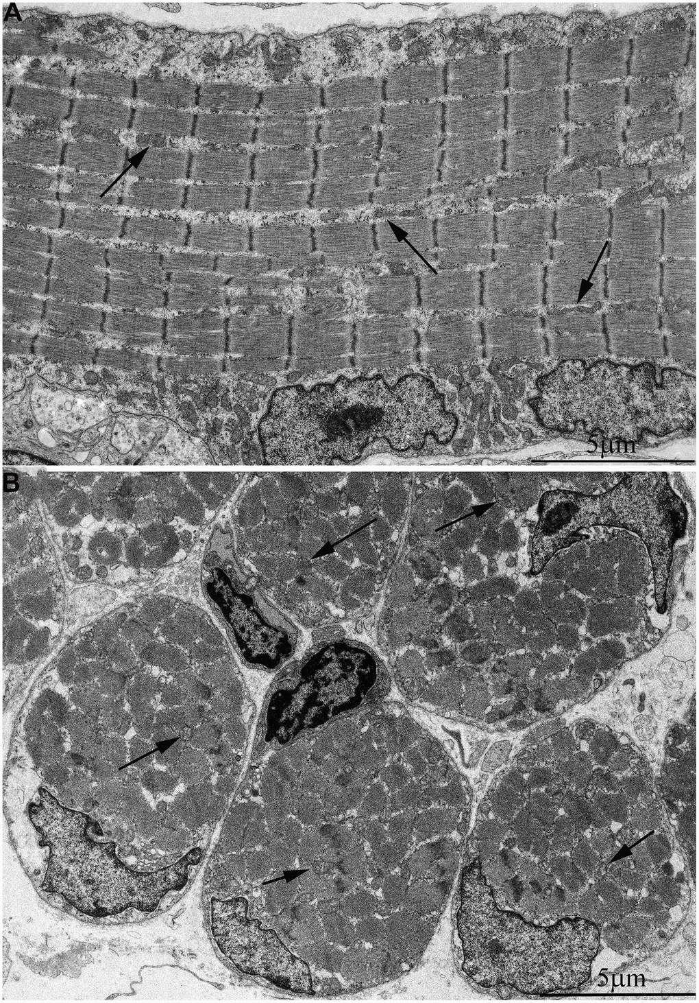 Ultrastructure of mitochondria in skeletal muscle of one-week-old naked mole rat. (A) Longitudinal section. Arrows indicate mitochondria. (B) Cross section. Widely spaced, small mitochondria are observed on the longitudinal and cross section of muscle fiber. Arrows indicate mitochondria.