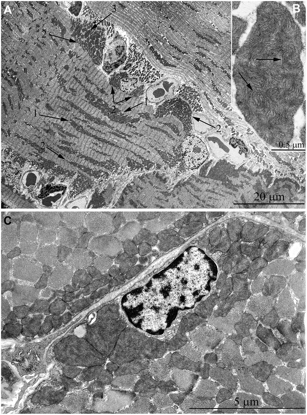 Ultrastructure of mitochondria in skeletal muscle of 11-year-old naked mole rat. (A) Longitudinal section of muscle fiber. Arrows 1 indicate large clusters of mitochondria located along myofibrils; arrows 2 indicate large clusters of mitochondria in the perinuclear and subsarcolemmal areas. Mitochondrion which specific ultrastructure is demonstrated under higher magnification in Figure 6B is indicated by arrow 3. (B) Mitochondrion which specific ultrastructure, convoluted stacks of cristae are indicated by arrows. (C) Cross section of muscle fiber. Similar ultrastructural pattern in the cross-section of muscle fiber is typical of cross-sections of cardiomyocytes, excluding subsarcolemmal localization of the nucleus.