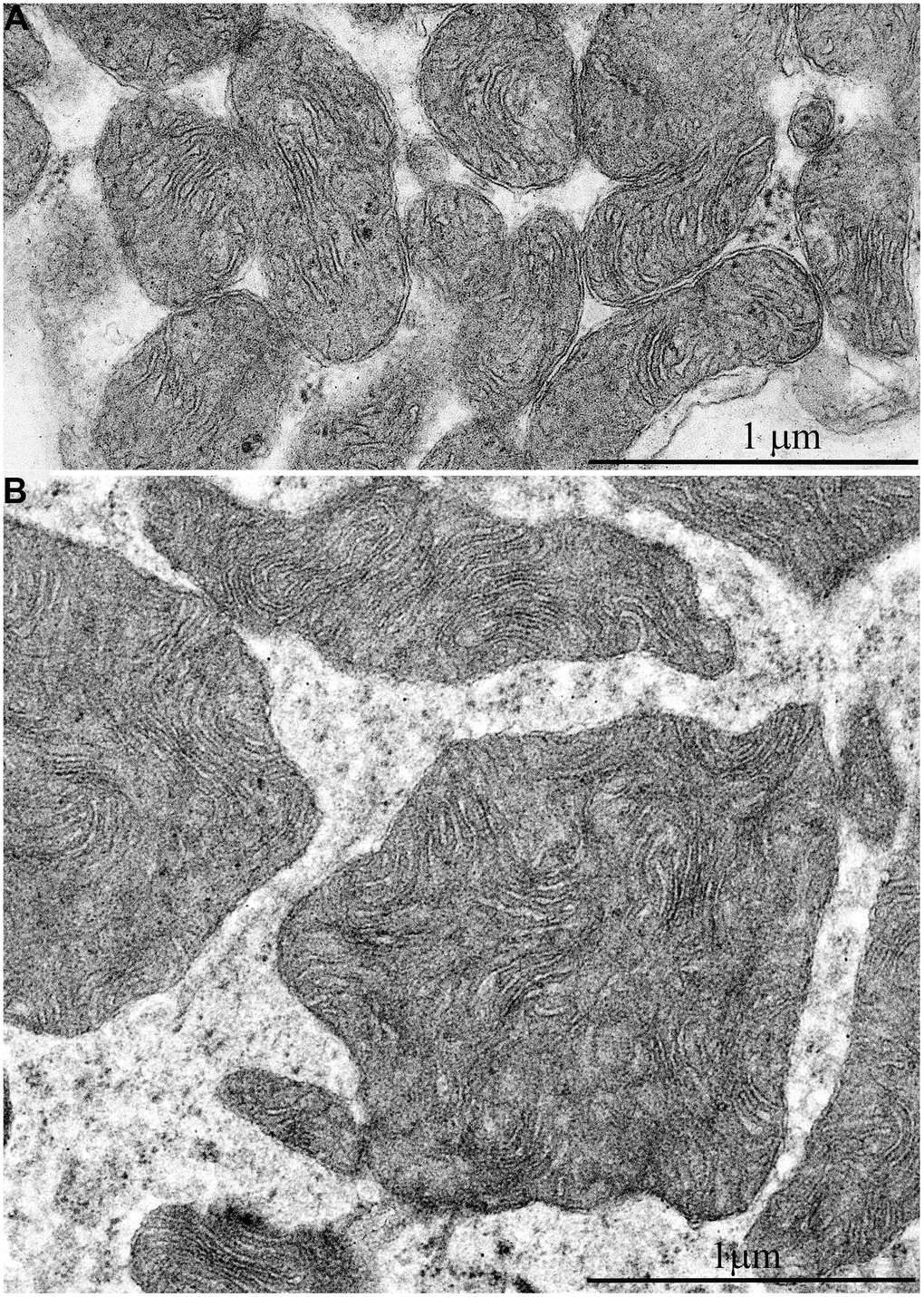 Comparison of ultrastructures of mitochondria in skeletal muscle fibers of naked mole rats of two different ages is shown at the same magnification: (A) Skeletal muscle mitochondria at the age of 6 months; (B) Skeletal muscle mitochondria at the age of 11 years.
