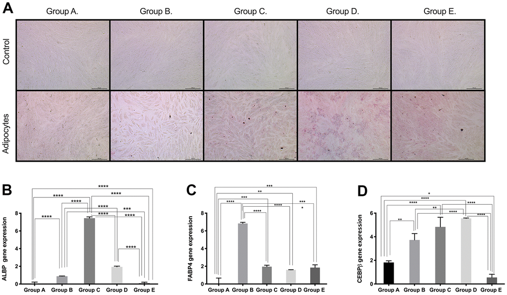 Adipogenic differentiation ability of PDMSCs from different maternal age group. (A) Representative image of adipogenic differentiation of all 5 age groups. Upper panel showed that undifferentiated cells did not retain Oil-O Red staining. Lower panel showed that differentiated cells were positive to Oil-O Red staining. Real Time PCR performed to measure the gene expression of (B) Adipocyte lipid binding protein (ALBP) (C) Fatty acid-binding protein 4 (FABP4), and (D) CCAAT/enhancer-binding protein beta (CEBPB) of all 5 age groups. Group A: 18-21; Group B: 22-25; Group C: 26-30; Group D: 31-35; Group E: 36 and over. *, pppp