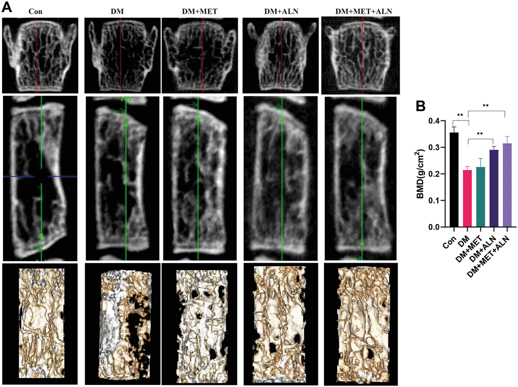 The effect of metformin and alendronate on bone microstructure in lumbar vertebra. (A) 3D image of Micro-CT. (B) BMD of spine.