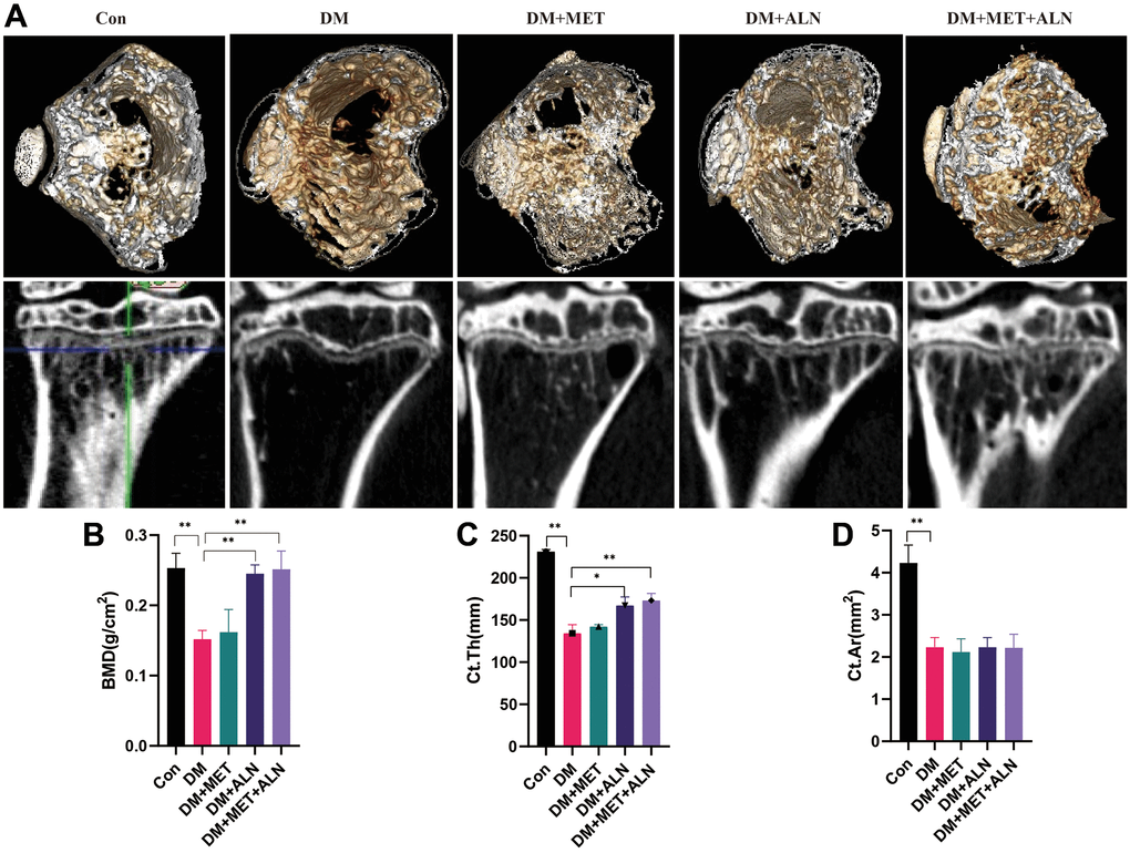 The effect of metformin and alendronate on bone microstructure in tibia. (A) 3D image of Micro-CT in tibia. (B) BMD of tibia. (C) Ct.Th in tibia. (D) Ct.Ar in tibia.