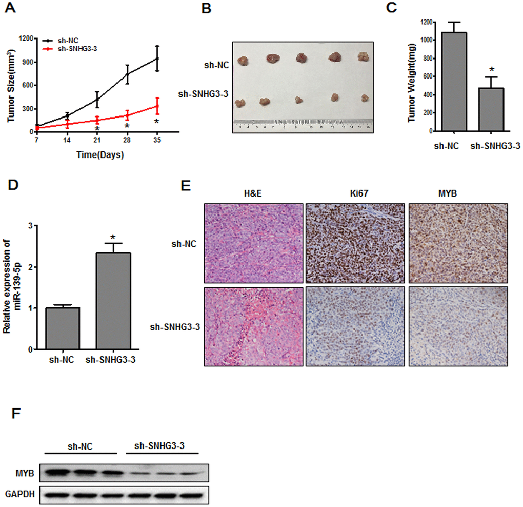 The inhibition of SNHG3 suppresses in vivo tumor growth. (A) Tumor growth in nude mice was monitored, *PB, C) Tumor size and weight values were measured at the end of the experimental period, *PD) miR-139-5p expression was assessed. *PE) Ki-67 and MYB levels in xenograft tumors were measured via IHC. (F) MYB protein levels in xenograft tumors were assessed via Western blotting.
