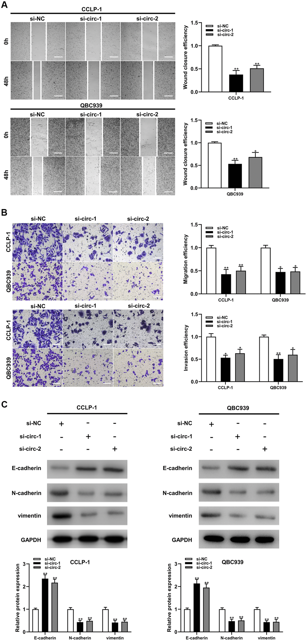 Silencing circ-ZNF609 inhibited cholangiocarcinoma cells migration and invasion. (A) Wound healing assay was used to detect the migration ability of CCA cells after circ-ZNF609 knockdown. (B) The migration and invasive abilities of CCLP-1 and QBC939 were confirmed by transwell assay after silencing circ-ZNF609. (C) Western blot was used to detect EMT-related proteins including E-cadherin, N-cadherin and vimentin. **PP
