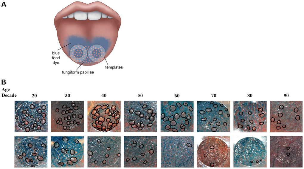 (A) Method to assess fungiform papillae density. Blue food coloring is used to provide optimal contrast between fungiform papillae (do not take up blue dye and appear pink) and other tongue structures (coated blue). Two clear plastic hole reinforcement templates (7 mm in diameter) are placed posterior to the apex of the tongue on each side of the median sulcus. Tongue images containing the two templates were taken using a digital camera. The fungiform papillae present within the two 7 mm holes were then counted and normalized to the area of the holes and expressed as fungiform papillae density (number of fungiform papillae/cm2). (B) Representative tongue images from 16 participants with age spans from the 20s to the 90s. As shown, fungiform papillae density varies widely among individuals and across lifespan. The top panel shows individuals with higher fungiform papillae density versus those individuals with lower fungiform papillae density in the lower panel.