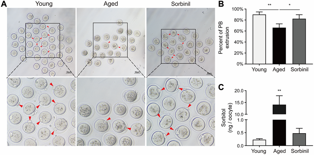 The in vitro oocyte maturation of aged mice. (A) The in vitro maturation of oocytes of aged mice and young mice and the effect of sorbinil as an inhibitor of AR. The red arrows in the images identify oocytes that extruded the first polar body (PB). (B) The first polar body extrusion in aged oocytes (aged) was increased by sorbinil. Each group had at least 20 oocytes. (C) The level of sorbitol in aged IVM oocytes was significantly higher than that in young IVM oocytes (n = 50). The level of sorbitol in aged IVM oocytes was decreased by sorbinil (sorbinil), suggesting the inhibitory effect of sorbinil on sorbitol accumulation. All experiments were repeated at least three times. Scale bar = 50 μm, *P **P 