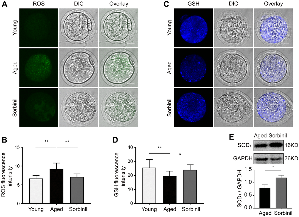 Effects of sorbitol accumulation on the levels of ROS and GSH and the expression of SOD1 in IVM oocytes. (A) The levels of ROS in young IVM oocytes (young), aged IVM oocytes (aged), and aged IVM oocytes treated with sorbinil (sorbinil). Fifteen oocytes in each group from three independent experiments were tested. (B) The differences in ROS levels in the above three groups. Fifteen oocytes in each group from three independent experiments were tested. (C) The levels of GSH in above three groups. (D) The differences in GSH levels in the above three groups. (E) The expression of SOD1 in the IVM oocytes. All experiments were repeated at least three times. Scale bar = 50 μm, *P **P 