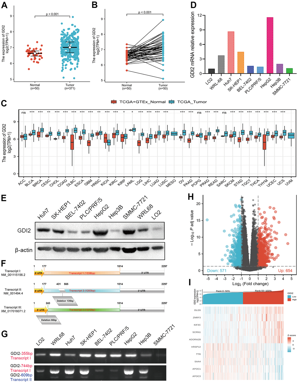 Differentially expressed genes (DEGs) involved in GDI2 expressing cancer groups. (A) Elevated expression of GDI2 between Normal and Tumor tissues of HCC patients. (B) Elevated expression of GDI2 in 50 paired Normal-and-Tumor tissues of HCC patients. (C) Box plot of the differentially expression of GDI2 gene among 33 kinds of pan-cancers. The X-axis represents the pan-cancer types, while the Y-axis denotes the expression of GDI2. (D) qRT-PCR assay confirmed the GDI2 mRNA expressions in two normal hepatic cells and seven hepatoma cells. (E) Western blot assay confirmed the protein levels of GDI2 in two normal hepatic cells and seven hepatoma cells. (F) Structural diagram of Transcript I, II and III of GDI2 gene. (G) Electrophoretogram for expressions of Transcript I, II and III of GDI2 gene based on different fragments of PCR primers in two normal hepatic cells and seven hepatoma cells. (H) Volcano plot of differential gene profiles between GDI2-high and -low groups. In 1225 DEGs, 654 upregulated and 571 downregulated genes were represented by red and blue tones, respectively. (I) Heat map of 10 significantly differentially expressed DEGs between GDI2-high and -low groups. Normalized expression levels are shown in descending order from red to blue. *P P P 