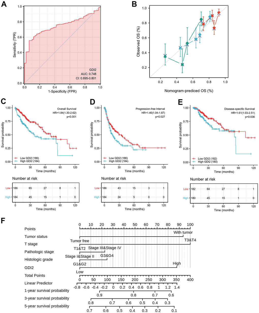 Effective nomogram model for prognostic evaluation of GDI2. (A) ROC analysis of GDI2 showing a high ability to discriminate controls from liver samples validated in TCGA. The X-axis represents False Positive Rate (FPR), while the Y-axis denotes True Positive Rate (TPR). AUC is plotted as sensitivity% vs 100-specifificity%. (B) Nomogram to predict survival probability at 1, 2, and 3 years of OS for HCC patients. (C–E) High GDI2 expression was associated with poor outcomes on (C) overall survival (OS), (D) progression-free interval (PFI), and (E) disease-specific survival (DSS) in HCC patients of a TCGA cohort. Blue: high GDI2 (n=184); Red: low GDI2 (n=186). *P **P F) Calibration curve with Hosmer-Lemeshow test of the nomogram-predicted OS (%) in the TCGA-LIHC cohort relating to GDI2 expression and tumor status, as well as T Stage, Pathologic Stage and Histologic Grade. The X-axis represents Prognostic Probability (0-100%), while the Y-axis denotes Observed OS (0-100%). Gray line: ideal line.