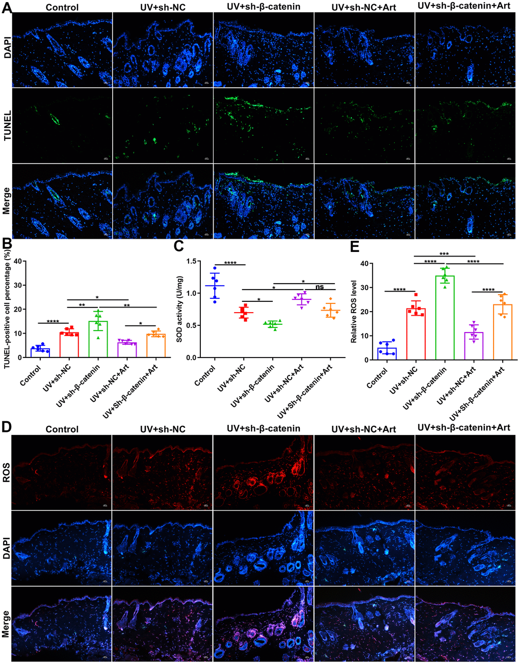 The effects of Art treatment and silencing β-catenin expression on apoptosis and ROS and SOD production in skin tissues of mice. (A, B) TUNEL staining of skin tissues for assessing cell apoptosis in control group, UV + sh-NC group, UV + sh-β-catenin group, UV + sh-NC + Art group and UV + sh-β-catenin + Art group. Scale bar: 100 μm. Magnification: 200×. (C) Detection of SOD levels in skin tissues of mice from each group. (D, E) Immunofluorescence for intracellular ROS production in skin tissues of mice from each group. Scale bar: 100 μm. Magnification: 200×. Ns: not significant; *p