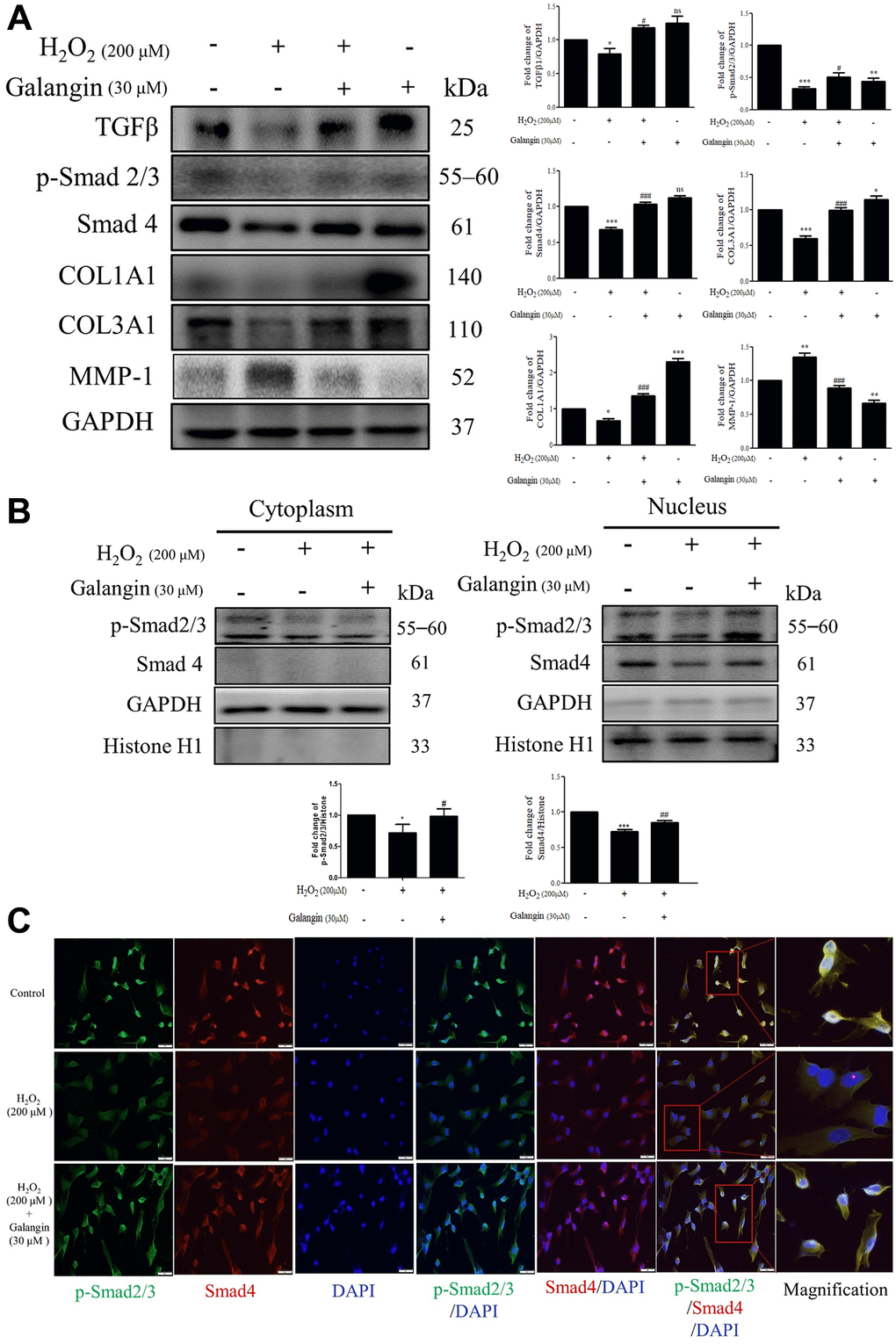 Galangin attenuates H2O2-induced TGFβ/Smad collagen synthesis pathway impairment in HS68 cells. (A) HS68 cells were exposed to H2O2 (200 μM) for 1 h and then treated with galangin (30 μM) for 23 h. Protein expression of collagen synthesis-related pathway components (TGFβ, p-smad2/3, Smad4, COL1A1, COL3A1) and collagen degradation-related protein (MMP-1) were detected by western blot. (B) The protein expression of p-smad2/3, Smad4 in the nuclear and cytosolic fractions was detected by western blotting. GAPDH was used as a loading control. Values are shown as mean ± SE. Quantification of the results is shown (n = 3) *P **P ***P #P ##P ###P 2O2-treated cells. (C) Anti-p-Smad2/3, Smad4 antibody, and FITC/PE-conjugated secondary antibody were used to detect p-Smad2/3 (green), Smad4 (red) expression. DAPI indicated the nucleus location (blue). The images were captured using a florescence microscope (200×).
