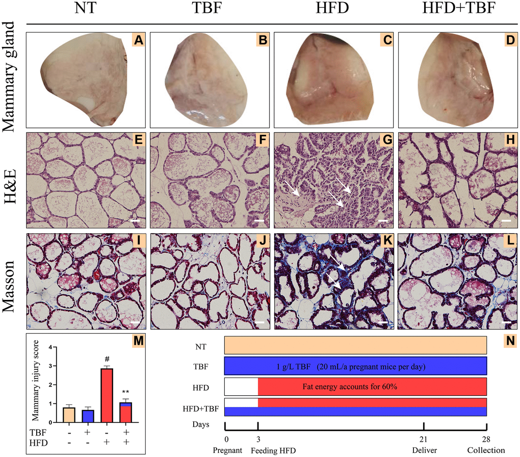 Effects of Tartary buckwheat flavonoids (TBF) on mammary gland tissues of mice induced by high fat diet (HFD) during pregnancy and lactation. 1 g/L TBF was dissolved in 0.1% carboxymethylcellulose sodium solution and was ingested by mice by drinking water. Drinking water administration began on the first day of mating and stopped one week after delivery, and then mammary tissue was collected. The mice mammary tissue was made into paraffin sections, which were used for H&E staining and Masson staining. (A–D) Mice mammary tissue; (E–H) H&E staining result of mammary tissue; (I–L) Masson result of mice mammary, blue represents collagen fiber, red represents muscle fiber; (M) Mammary gland damage score; The arrow represents the lesion of mammary tissue; (N) Schematic diagram of the mice experiment cycle; The arrow represents the lesion of mammary tissue; H&E and Masson are the results of 200× magnification, Scale bar: 100 μm. The data error was based on SEM, three independent repeated experiments were performed; #p ∗∗p 
