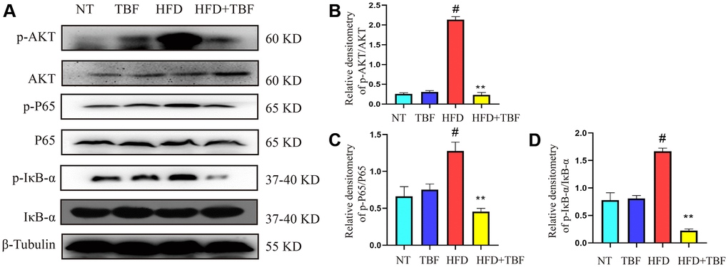 The effect of TBF on AKT/NF-κB signal induced by HFD during pregnancy and lactation. 1 g/L TBF was dissolved in 0.1% carboxymethylcellulose sodium solution and was ingested by mice by drinking water. Drinking water administration began on the first day of mating and stopped one week after delivery, and then mammary tissue was collected. (A) Protein bands of p-AKT, p-P65, p-IκB, AKT, P65, IκB, β-Tublin; (B) Analysis of relative density value of p-AKT protein; (C) Analysis of relative density value of p-P65 protein; (D) Analysis of the relative density value of p-IκB protein. The data error was based on SEM, three independent repeated experiments were performed; #p ∗∗p  0.01 vs. HFD group.