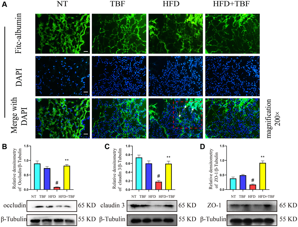 The effect of TBF on the blood-milk barrier induced by HFD during pregnancy and lactation. Fresh mice mammary tissue was immersed in 2 mg/mL FITC for 15 min, then the mammary tissue block was placed in liquid nitrogen, and finally the tissue block was frozen sectioned by a cryostat. After DAPI staining, the sections were sealed with anti-fluorescence quenching reagent, finally obtain the experimental results. FITC green fluorescent protein shuttle freely between the fresh mammary acinar interstitiumed and leaked into the damaged mammary acinar. In addition, FITC will show large green fluorescence in the mammary tissue with acinar atrophy matrix thickening. The lesion was shown by the arrow in the figure, and the scale bar is 100 μm. (A) Flow trajectory of FITC solution in mammary gland; (B) Occludin protein band and relative density analysis results; (C) Analysis results of the band and relative density value of Claudin-3 protein; (D) ZO-1 protein band and relative density analysis results; β-Tublin was used as a reference for protein control. The data error was based on SEM, three independent repeated experiments were performed; #p ∗∗p 