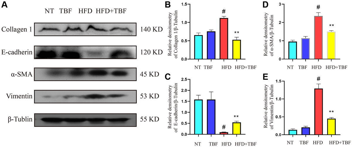Tartary buckwheat flavonoids relieve the tendency of mammary fibrosis