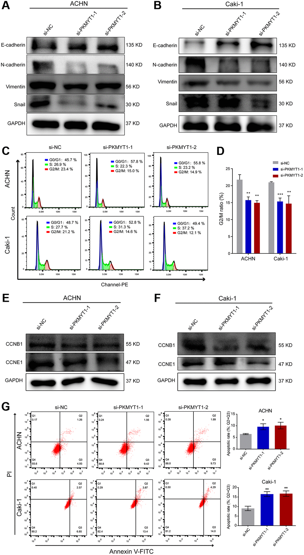 Downregulation of PKMYT1 inhibits epithelial-mesenchymal transition (EMT), promotes apoptosis, and decreases the G2/M ratio in the cell cycle. (A–B) Western blot analysis showing changes in EMT-related biomarkers in the ACHN and Caki-1 cell lines. Expression of E-cadherin was increased in the siRNA groups, while expression of N-cadherin, Vimentin, and Snail was decreased. (C) Representative images of flow cytometry results for the cell cycle in ACHN and Caki-1 cells. (D) Results showing reduction of G2/M ratio in cell cycle of ACHN and Caki-1 cells transfected with PKMYT1 siRNA versus a negative-control siRNA. (E–F) Western blot analysis of the protein expression levels of CCNB1 and CCND1 in ACHN and Caki-1 cell lines transfected with a negative-control siRNA or PKMYT1 siRNA. (G) Flow cytometry showing that inhibiting the expression of PKMYT1 contributed to a high apoptosis rate in ACHN and Caki-1 cells. *P **P ***P 
