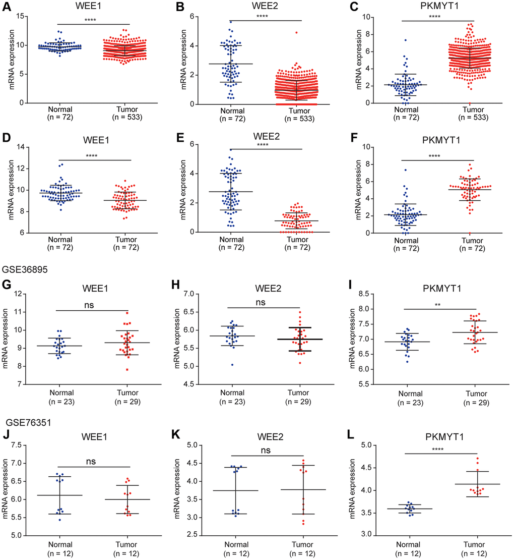 Differential expression analysis of WEE family kinases. Expression levels of WEE1 (A) and WEE2 (B) were down-regulated in tumors (normal (n = 72); tumor (n = 533)), while PKMYT1 (C) was up-regulated in tumors compared with normal tissue samples in the TCGA dataset. A consistent result for WEE1 (D) and WEE2 (E) were also obtained for paired normal and tumor samples (normal (n = 72); tumor (n = 72)), while PKMYT1 was up-regulated in tumors (F). Expression levels of WEE1 and WEE2 exhibited no significant difference in the GSE36895 (G, H). PKMYT1 was up-regulated in tumors in the GSE36895 (I). Expression levels of WEE1 and WEE2 exhibited no significant difference in the GSE76351 (J, K). PKMYT1 was up-regulated in tumors in the GSE36895 (L).