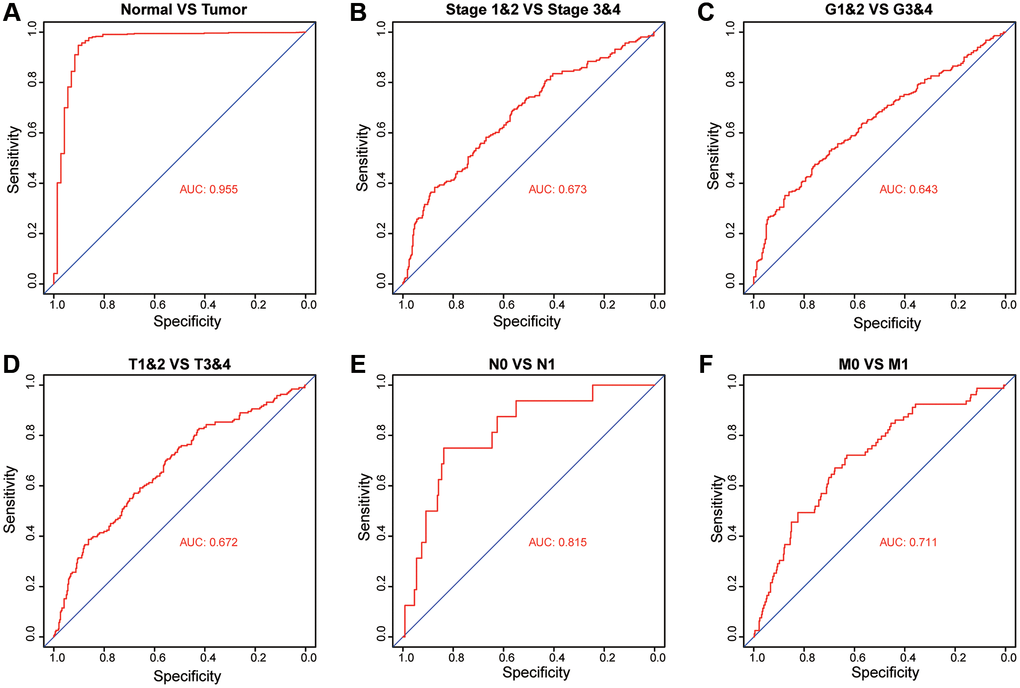 Diagnostic value of PKMYT1 mRNA expression for ccRCC patients in the TCGA dataset. Receiver operating characteristic curves for PKMYT1 to distinguish tumors from normal tissues (A), stage I + II vs. stage III + IV (B), G1&G2 vs. G3&G4 (C), T1&T2 vs. T3&T4 (D), N0 vs. N1 (E), and M0 vs. M1 (F).