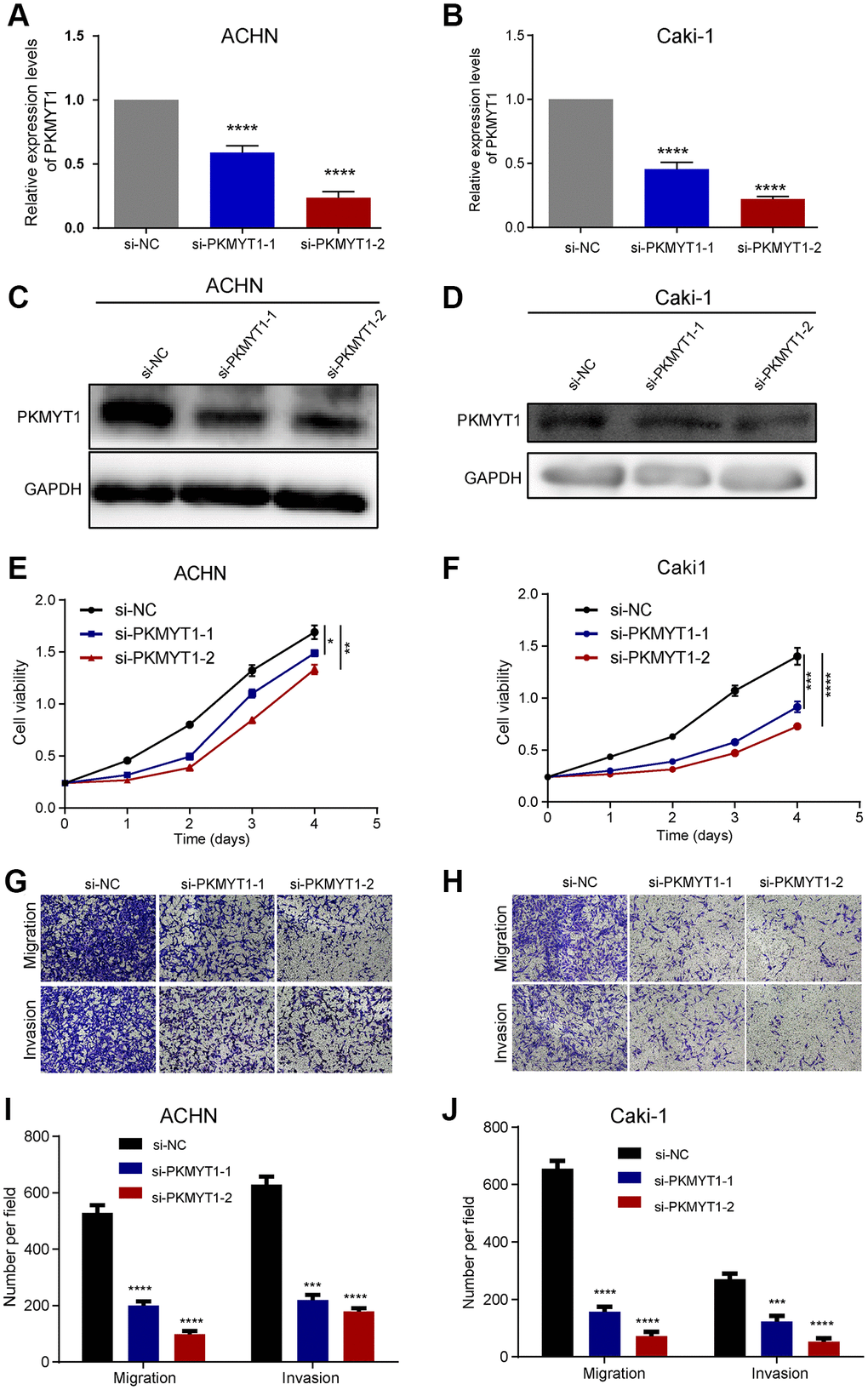 PKMYT1 promotes the proliferation, migration, and invasion of renal cancer cells in vitro. The mRNA expression of PKMYT1 in ACHN (A) and Caki-1 cells (B) was measured using real-time quantitative reverse transcription-PCR. The protein expression of PKMYT1 in ACHN (C) and Caki-1 cells (D) by western blotting assays. Cell Counting Kit-8 assays were used to detect the effect of PKMYT1 knockdown on cell proliferation in ACHN (E) and Caki-1 (F) cells. Representative images of migration and invasion assays for ACHN (G) and Caki-1 (H) cells. Transwell migration and invasion assays indicated that the migration and invasion abilities of PKMYT1 were weakened in siRNA groups for ACHN (I) and Caki-1 (J) cells. Data are shown as the mean ± standard deviation from three independent experiments, and were compared to the respective si-NC group. ****P ***P **P *P 