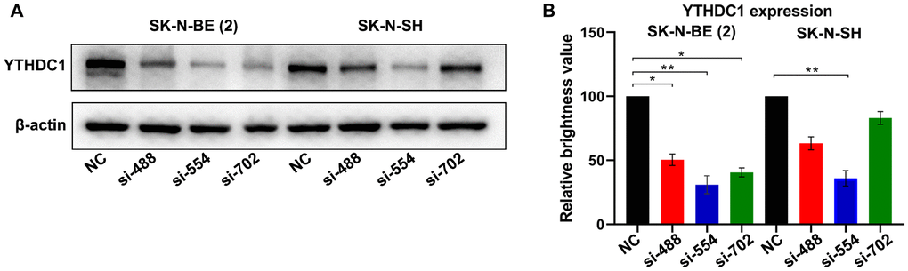 Verification of the silencing effect of different interference sites of YTHDC1 in NB cells. (A) YTHDC1 expression in SK-N-BE (2) and SK-N-SH cells transfected with YTHDC1 siRNAs (siRNA-488, siRNA-554, siRNA-702 and siRNA-NC) were detected by Western blot. (B) Quantitative analysis of YTHDC1 expression in SK-N-BE (2) and SK-N-SH cells.