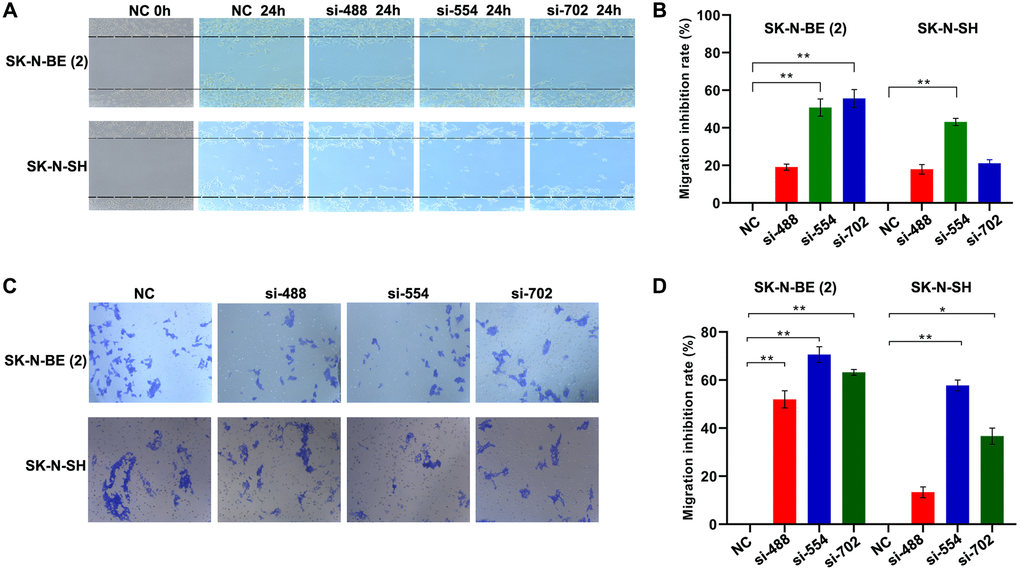 Silencing YTHDC1 inhibited NB cells migration. (A) Migration ability of SK-N-BE (2) and SK-N-SH cells were evaluated by wound healing assay after transfection for 24 h. (B) Quantitative analysis of the migration inhibition rate of SK-N-BE (2) and SK-N-SH cells. (C) Identifying migration ability of SK-N-BE (2) and SK-N-SH cells transfected with YTHDC1 siRNAs for 24 h by transwell migration assay. (D) Quantitative analysis of SK-N-BE (2) and SK-N-SH cell migration inhibition rate. Data were represented as the means ± SD, *P **P 