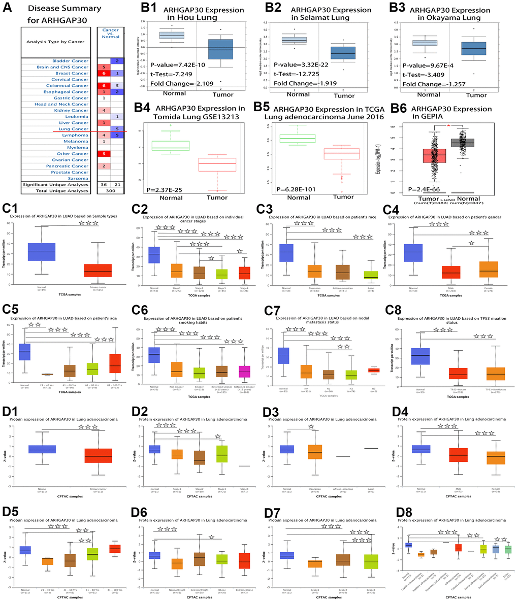 Comparison of mRNA and protein expression of ARHGAP30 in lung cancer tissues and normal tissues. (A) Summary view of ARHGAP30. The transcription level of ARHGAP30 in different types of cancer. P-value B) Transcription of ARHGAP30 in lung adenocarcinoma (from Oncomine, SurvExpress, and GEPIA databases). mRNA expression levels of ARHGAP30 were significantly higher in lung adenocarcinoma than in normal tissue. (B1–B3) The fold change, associated p-values, and overexpression Gene Rank, based on Oncomine 4.5 analysis. Box plots show ARHGAP30 mRNA levels in the Hou Lung, Selamat Lung, and Okayama Lung datasets. (B4, B5) The expression of ARHGAP30 in LUAD based on SurvExpress analysis; (B6) The expression of ARHGAP30 in LUAD based on GEPIA analysis; P values as described in the figure are statistically significant. (C) ARHGAP30 transcription in subgroups of patients with lung adenocarcinoma, stratified based on sex, age, and other criteria (UALCAN). (C1) Sample types. (C2) Individual cancer stages. (C3) Ethnicity. (C4) Sex. (C5) Age. (C6) Smoking habits. (C7) Nodal metastasis status. (C8) TP53 mutation status. ☆, P D) Differential abundance of the ARHGAP30 protein in patients with lung adenocarcinoma, stratified by sex, age, and other criteria. (D1) Sample types. (D2) Individual cancer stages. (D3) Ethnicity. (D4) Sex. (D5) Age. (D6) Weight. (D7) Tumor grade. (D8) Tumor histology. ☆, P 