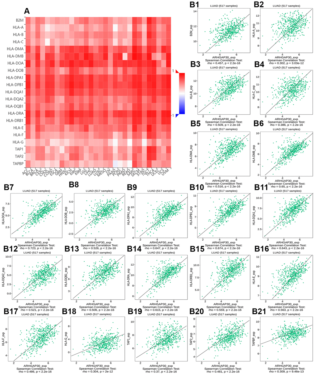 The correlation between the expression of ARHGAP30 and immune inhibitors. (A) Heat map of Spearman correlations between ARHGAP30 expression and immune inhibitors across human cancers. (B1–B21) Scatter plots showing the positive correlation between ARHGAP30 expression and immune inhibitors in the treatment of lung adenocarcinoma.