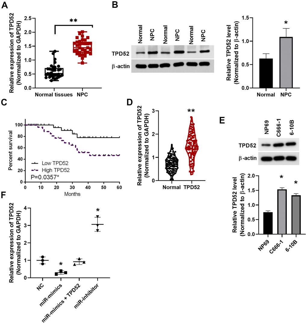 Upregulation of TPD52 in NPC patient tissue and cell lines. (A) TPD52 expression was analyzed in NPC tissues via qRT-PCR. N=33. (B) TPD52 protein levels were analyzed by western blot and normalized to β-actin (N=10). (C) Low TPD52 expression predicted good prognosis in NPC patients. (D) High TPD52 expression in NPC was found in public available study cohorts in TCGA database (N=102). (E) High TPD52 protein levels in NPC cell lines (N=3). (F) TPD52 expression was measured in C666-1 cells transfected with miR-212 mimics and inhibitor (N=3). *p p 