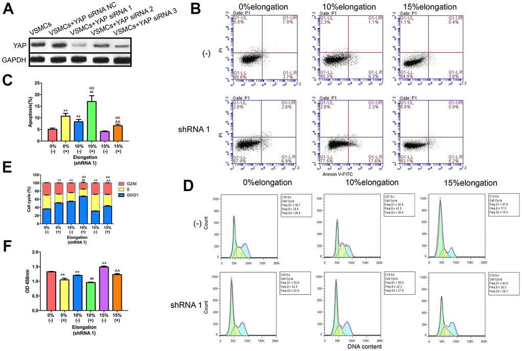 Knockdown of YAP impairs proliferation and apoptosis of VSMCs under different intensities of mechanical stretch. (A) The level of YAP expression in VSMCs transfected with YAP small interfering RNA (siRNA). (B) Apoptosis of VSMCs was detected by flow cytometry. (C) Quantitative analysis of apoptosis in VSMCs. (D) The cell cycle of VSMCs was detected by flow cytometry. (E) Quantitative analysis of the cell cycle in VSMCs. (F) The proliferation of VSMCs was detected by CCK-8. Values are expressed as means±SD. **P ##P ^^P @@P 