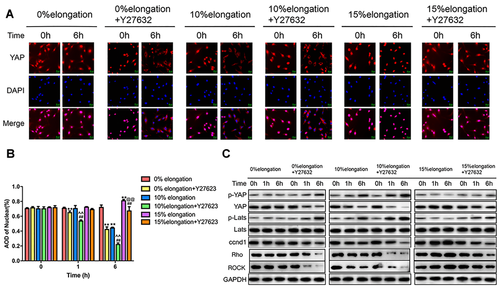 Inhibition of the Rho-ROCK pathway affects the Hippo pathway under different intensities of stretch. (A) The YAP localization of VSMCs was detected by immunocytochemistry. (B) Quantification of nuclear YAP amount in VSMCs. (C) The levels of phosphorylated YAP, phosphorylated Lats and ccnd1 in VSMCs were detected by western blotting. Values are expressed as means±SD. **P ##P ^^P @@P 