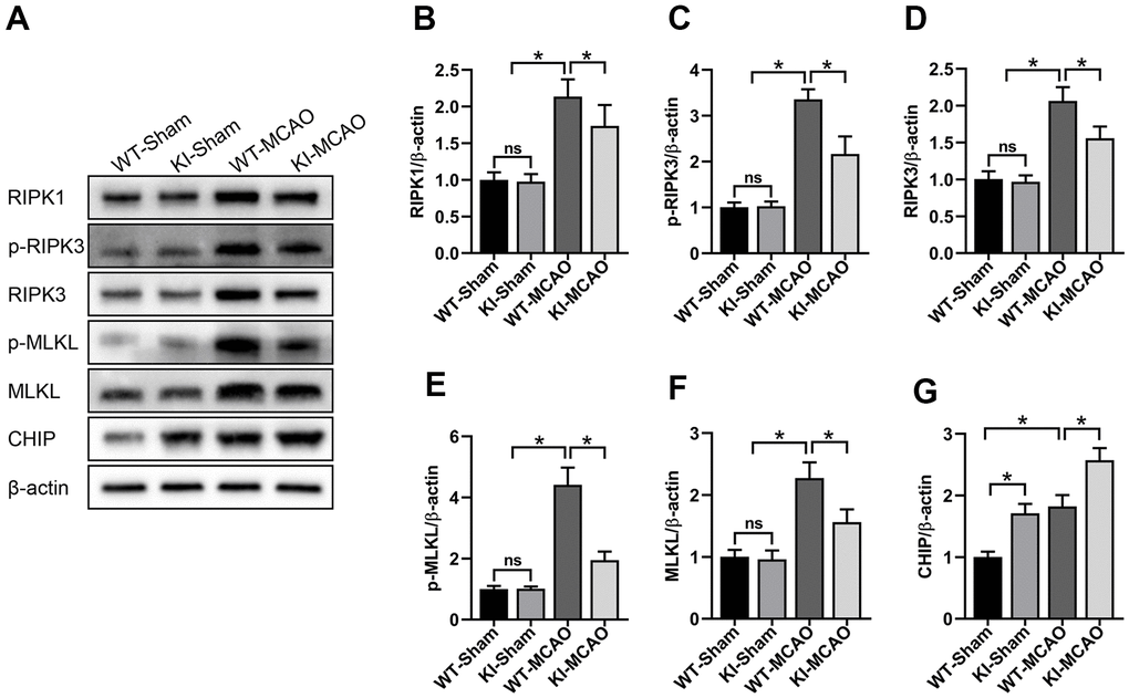 CHIP overexpression attenuated necroptosis induced by MCAO. (A) Western blot of RIPK1, p-RIPK3, RIPK3, p-MLKL, MLKL, and CHIP in the peri-infarct tissues after MCAO. (B–F) Quantitative analysis of RIPK1, p-RIPK3, RIPK3, p-MLKL, and MLKL in the peri-infarct tissues after MCAO. (G) Quantitative analysis of CHIP. Data are presented as the mean ± SEM; n=6/group; ns, no significant difference; *P 
