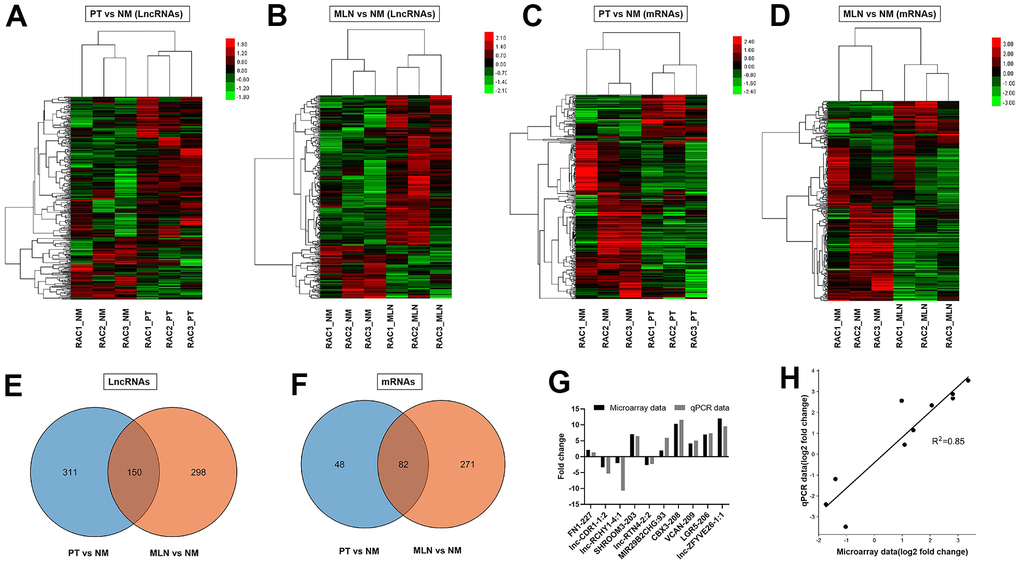 Differential expression analysis of lncRNAs and mRNAs in CRC. (A) Hierarchical cluster analysis of differentially expressed lncRNAs in primary tumor (PT) versus normal colorectal mucosa tissue (NM). (B) Hierarchical cluster analysis of differentially expressed lncRNAs in metastatic lymph nodes (MLNs) versus NM. (C) Hierarchical cluster analysis of differentially expressed mRNAs in PT versus NM. (D) Hierarchical cluster analysis of differentially expressed mRNAs in MLN versus NM. Venn diagrams showing the numbers of differentially expressed lncRNAs (E, F) in MLNs compared with those in PTs. (G) Verification of microarray data using qRT-PCR (H) Correlation analysis of gene expression between microarray data and qRT-PCR data. Microarray data were plotted against data from quantitative real-time PCR. Both the x -and y-axes were shown on a log2 scale. R2 indicates the square of the correlation coefficient.
