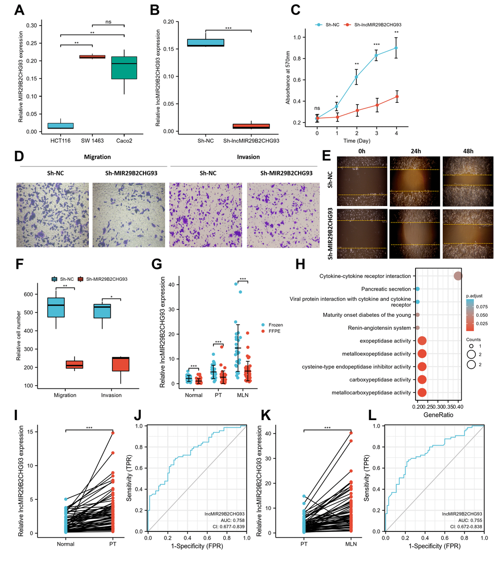 LncRNA MIR29B2CHG93 promoted cell proliferation and tumor metastasis in CRC. (A) RT-PCR analysis was used to detect the expression of lncRNA MIR29B2CHG93 in cell lines. (B) The expression levels of lncRNA MIR29B2CHG93 in Caco2 cells after transfection with sh-NC or sh-MIR29B2CHG93 were detected by RT-PCR. (C) The effects of lncRNA MIR29B2CHG93 knockdown on the proliferation of Caco2 cells were examined by MTT assay. (D–F) Transwell assay and wound healing assay were used to evaluate the migration and invasion ability of Caco2 cells transfected with sh-NC or sh-MIR29B2CHG93. (D) Images of Caco2 cells in migration and invasion transwell assays. (E) Cell mobility was determined by wound healing assay at 0, 24, 48h after the scratching. (F) Quantification of cell migration and invasion in (D). (G) The expression of lncRNA MIR29B2CHG93 was compared between in frozen tissue and FFPE tissues in normal mucosa, primary tumor and lymphnodal metastasis tumor tissue. (H) GO and KEGG analysis of lncRNA MIR29B2CHG93 based on co-expressed mRNAs. (I) LncRNA MIR29B2CHG93 expression in primary tumors compared with paired normal tissues from CRC cohort. (J) A ROC curve for assessing the predictive ability of lncRNA MIR29B2CHG in predicting normal and tumor. (K) LncRNA MIR29B2CHG93 expression in lymphnodal metastasis tumors compared with paired primary tumors from CRC cohort. (L) A ROC curve for assessing the predictive ability of lncRNA MIR29B2CHG in predicting lymphnodal metastasis. *P