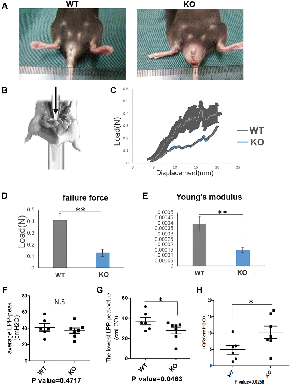 Loxl1 knockout mice mimic the phenotype and functional changes of clinical POP. (A) The gross pictures showed there was a pelvic organ prolapse phenotype in Loxl1 knockout mice. (B) The simulated image of pelvic floor support test. (C) The pelvic floor support test showed the different mechanical property of the pelvic floor from Loxl1 knockout mice and the wild type mice, horizontal axis represent the displacement (mm) and vertical axis represent the load (N), n = 4. (D, E) the failure force (D) and Young’s modulus (E) of pelvic floor showing that the values from the WT group were higher than the loxl1 knockout group, n = 4. (F–H) LPP was performed to test the urinary function, there were decreased average LPP-peak value (F) and decreased lowest LPP-peak value (G) while there was an increased Inter-Quartile Range (IQR) of the average LPP-peak value (H) in the Loxl1 knockout mice.