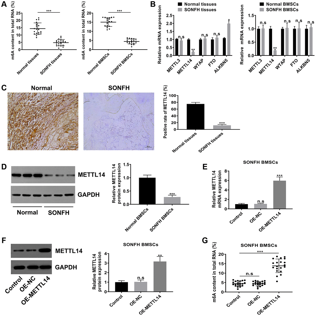 METTL14 was responsible for the aberrant m6A modification in BMSCs from SONFH patients. (A) The m6A content in total RNA of SONFH tissues and BMSCs (n = 20) and normal tissues and BMSCs (n = 20). (B) mRNA levels of m6A modification associated genes in SONFH tissues and BMSCs and normal tissues and BMSCs. (C) IHC assay determined the expression of METTL14 in osteonecrosis tissues and normal tissues. Scale bar = 100 μm. (D) The protein levels of METTL14 in SONFH BMSCs and normal BMSCs were measured by western blot. (E, F) The efficiency of METTL14 overexpression in SONFH BMSCs was confirmed by qRT-PCR and western blot analysis. (G) Quantitative m6A methylation assay was used to define the effect of METTL14 overexpression on the level of m6A modification in BMSCs from SONFH patients. *P **P ***P 