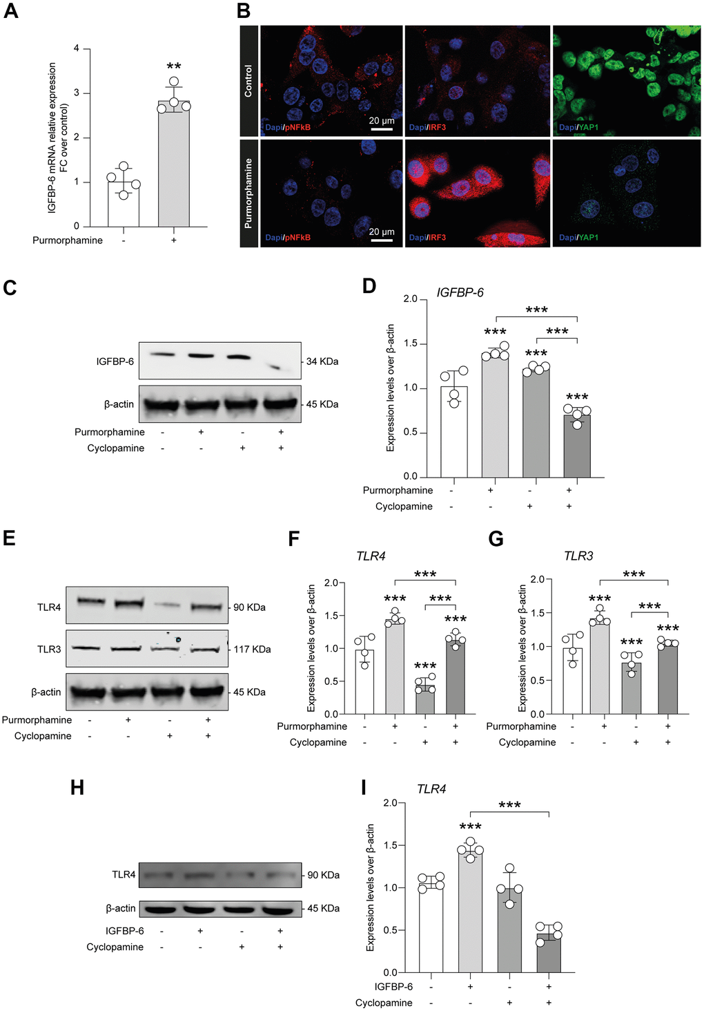 IGFBP-6-induced TLR4 signalling is controlled by SHH signalling through SMO. (A) qPCR results obtained for IGFBP-6 in HS5 cells exposed or not to purmorphamine. Relative mRNA expression level normalized with β-actin by using a comparative 2-ΔΔCt method. **P B) Immunofluorescence analysis were performed on HS5 cells exposed or not to purmorphamine, followed by fixing and staining with anti-pNF-kB (red), anti-IRF3 (red), and anti-YAP1 (green). Nuclei were visualized using DAPI. Immunoreactivity was evaluated considering the signal-to-noise ratio of immunofluorescence (scale bar 20 μm). (C) HS5 cells exposed to purmorphamine, cyclopamine, or both were lysed and subjected to immunoblotting using a specific antibody against IGFBP-6. Protein content was normalized to the housekeeping protein β-actin. The entire assay was made in triplicate, a representative one is shown. Signals from immunodetected bands were semi-quantified by densitometry. (D) Statistical analysis of data revealed that IGFBP-6 expression was significantly increased after exposure to purmorphamine. Data are presented as means ± sem. **p E) HS5 cells exposed to purmorphamine, cyclopamine, or both were lysed and subjected to immunoblotting using specific antibodies against TLR4 and TLR3. Protein content was normalized to the housekeeping protein β-actin. The entire assay was made in triplicate, a representative one is shown. Signals from immunodetected bands were semi-quantified by densitometry. (F, G) Statistical analysis of data revealed that purmorphamine was able to increase while cyclopamine was able to suppress both TLR4 (F) and TLR3 (G) protein expression levels. Co-treatment with both SMO agonist and antagonist did not affect TLR4 and TLR3 expression levels, as compared to control cell cultures. Data are presented as means ± sem. **p H) HS5 cells exposed to IGFBP-6, cyclopamine, or both were lysed and subjected to immunoblotting using a specific antibody against TLR4. Protein content was normalized to the housekeeping protein β-actin. The entire assay was made in triplicate, a representative one is shown. Signals from immunodetected bands were semi-quantified by densitometry. (I) Statistical analysis of data revealed that TLR4 expression levels were significantly increased after IGFBP-6 stimulation, while a cotreatment with cyclopamine had a reducing effect on TLR4 expression. Data are presented as means ± sem. **p 
