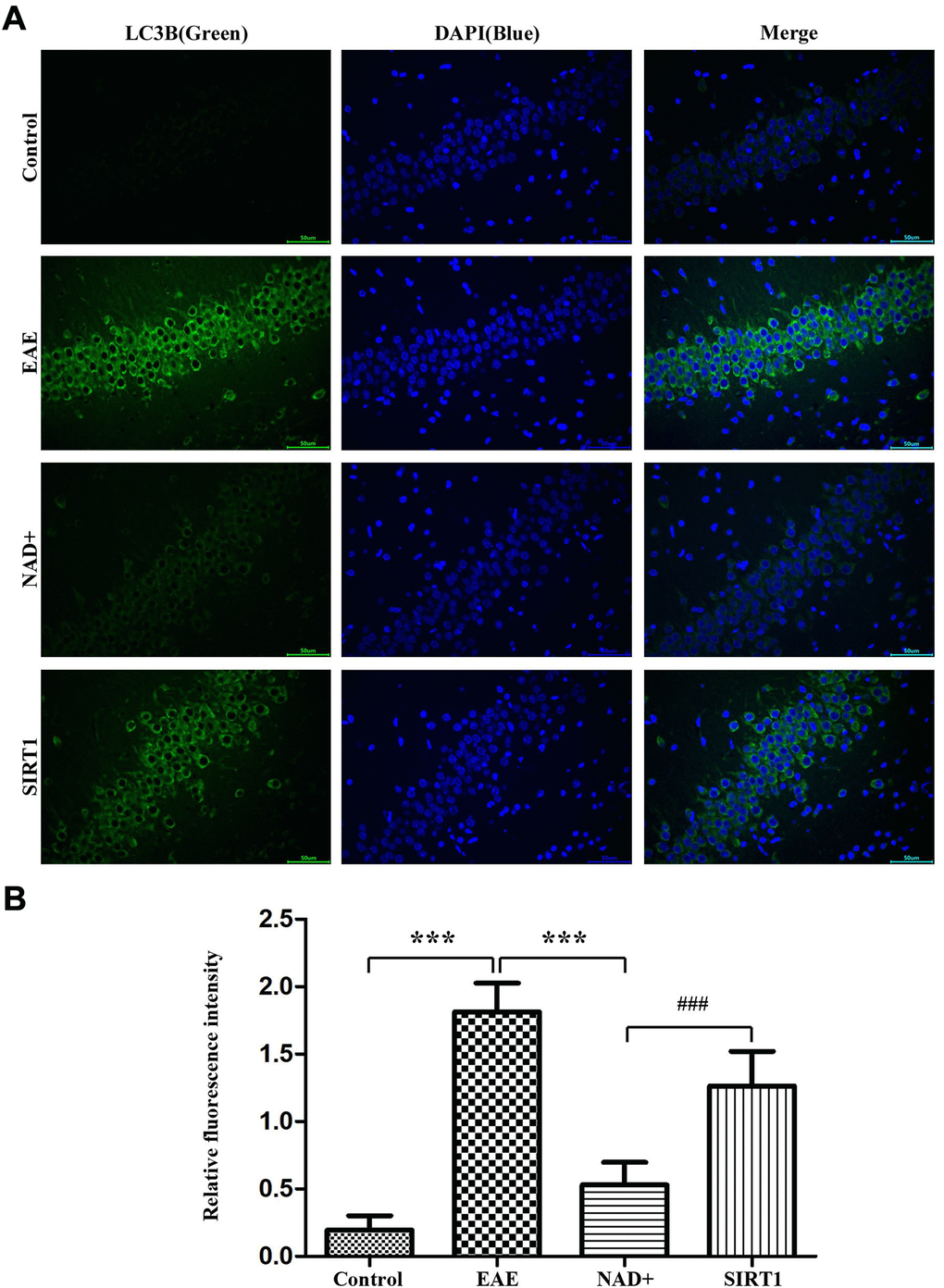 Autophagy degree of LC-3A/B at the level of mice. (A) Under fluorescence microscope, immunofluorescence staining was used to present the expression of LC-3A/B at the level of mice. (B) Column diagram manifesting the relative fluorescence intensity in the different group at the level of mice.