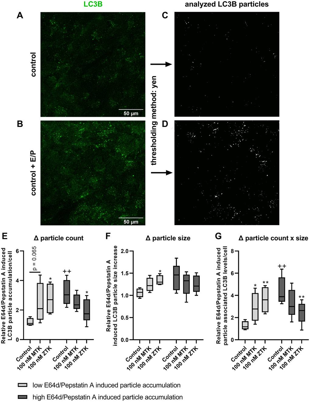 LC3B particle analysis in polarized ARPE-19 cells upon MTK and ZTK treatment. Representative IF images of polarized ARPE-19 cells in (A) the absence and (B) presence of lysosomal inhibitors E64d and pepstatin A for 3 h and the (C, D) corresponding LC3B particle count and size evaluation by ImageJ using the Yen thresholding method. Relative E64d/pepstatin A-induced LC3B particle (E) count accumulation, (F) size increase and (G) particle-associated LC3B levels/cell (particle count x size) of control, MTK- and ZTK-treated polarized ARPE-19 cells grouped in low and high E64d/pepstatin A-induced particle accumulation of control samples. Values are represented in box and whisker plot format (min to max); independent experiments: n = 4–5. The significance of differences in relative E64d/pepstatin A-induced LC3B particle count, size and count x size upon MTK and ZTK treatment was calculated by a repeated measures two-way ANOVA (main factors: low and high E64d/pepstatin A-induced particle accumulation and MTK/ZTK treatment (matched)) followed by a Dunnett multiple comparison test. **p *p ++p 