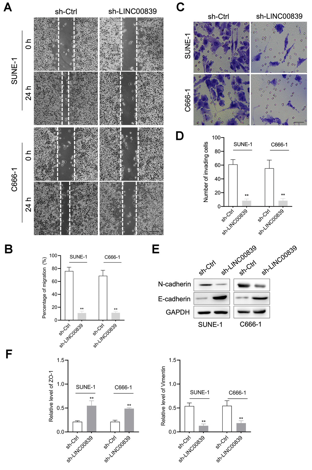 The role of LINC00839 in NPC cell migration and invasion. (A, B) After cell transfected with sh-LINC00839, cell migration was determined by wound healing assay. (C, D) Cell invasion was determined by Transwell assay. (E) The expressions of E-cadherin and N-cadherin were determined by western blot. (F) The mRNA levels of Vimentin and ZO-1 were measured by qPCR assay. **P 