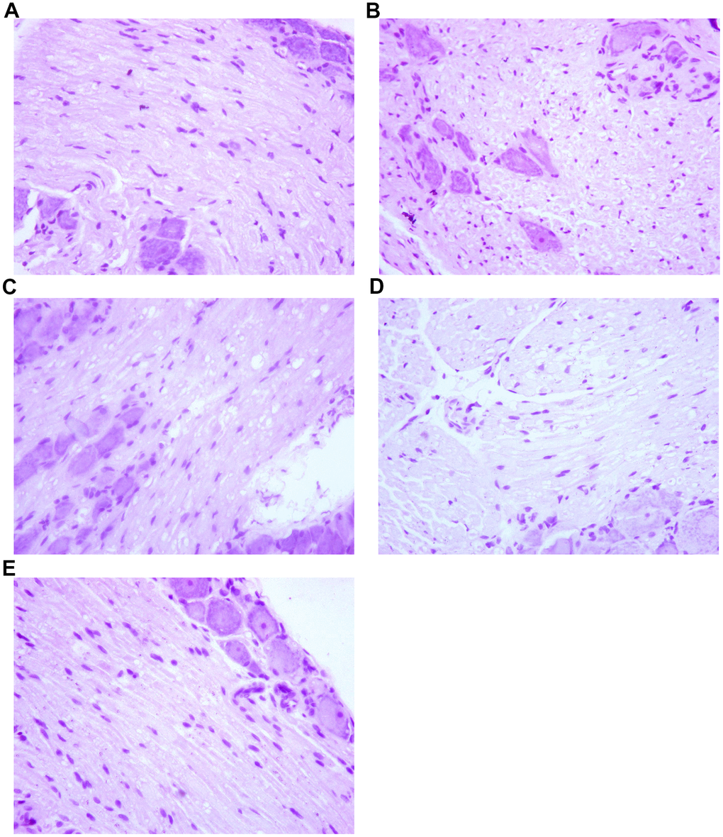 The effect of Huangqi Guizhi Wuwu Decoction on the morphology of nerve cells of L4-L5 dorsal root ganglions of different rat groups. (A–E) A group- E group.