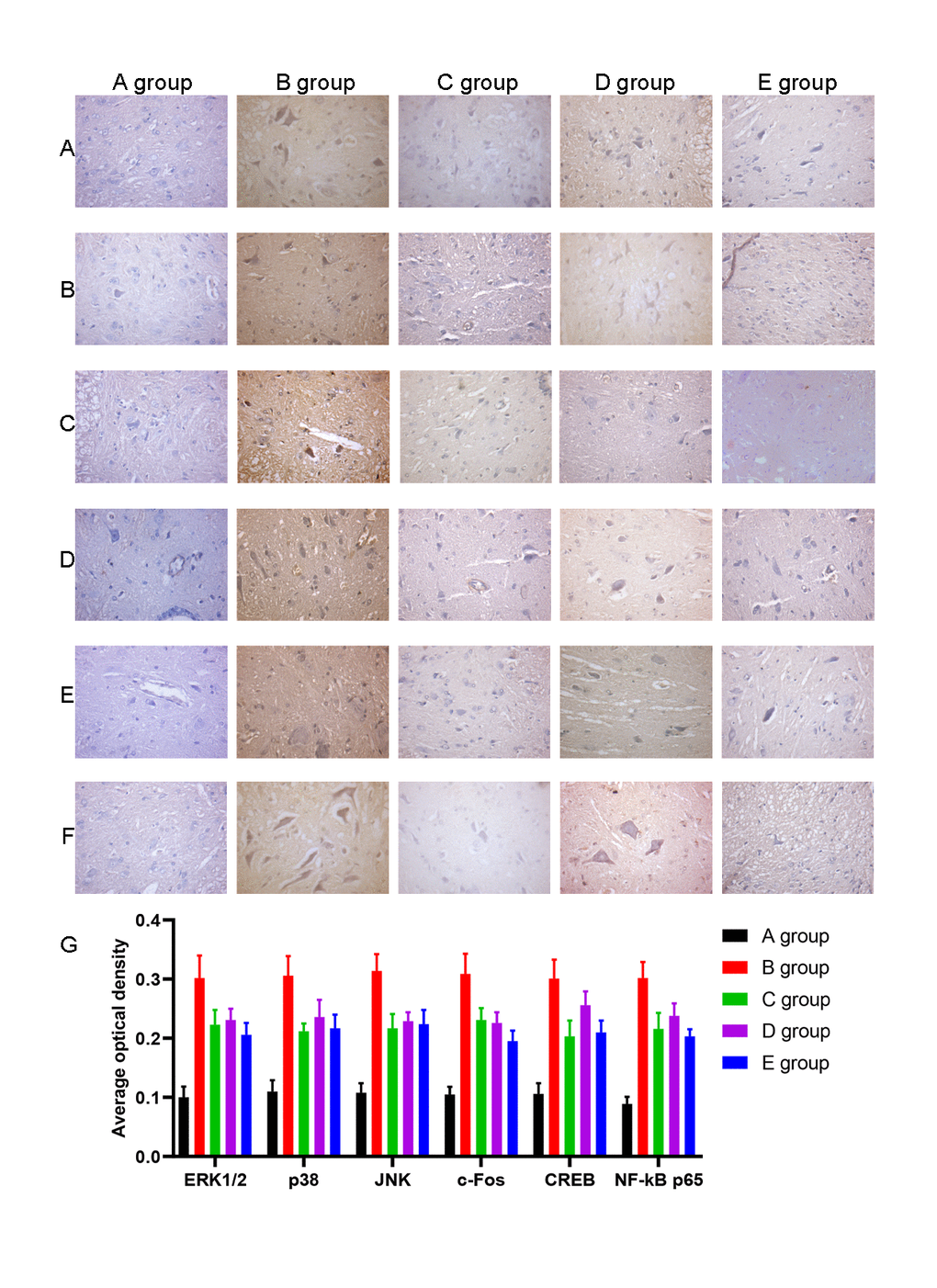 The effect of Huangqi Guizhi Wuwu Decoction on the expression of ERK1/2, p38, JNK, c-Fos, CREB and NF-kB in the L4-L5 dorsal root ganglions of different rat groups detected by IHC. (A–F) The typical pictures of ERK1/2, p38, JNK, c-Fos, CREB and NF-kB expression in the L4-L5 dorsal root ganglions of different rat groups detected by IHC. (G) The average optical density of ERK1/2, p38, JNK, c-Fos, CREB, and NF-kB expression in the L4-L5 dorsal root ganglions of different rat groups.