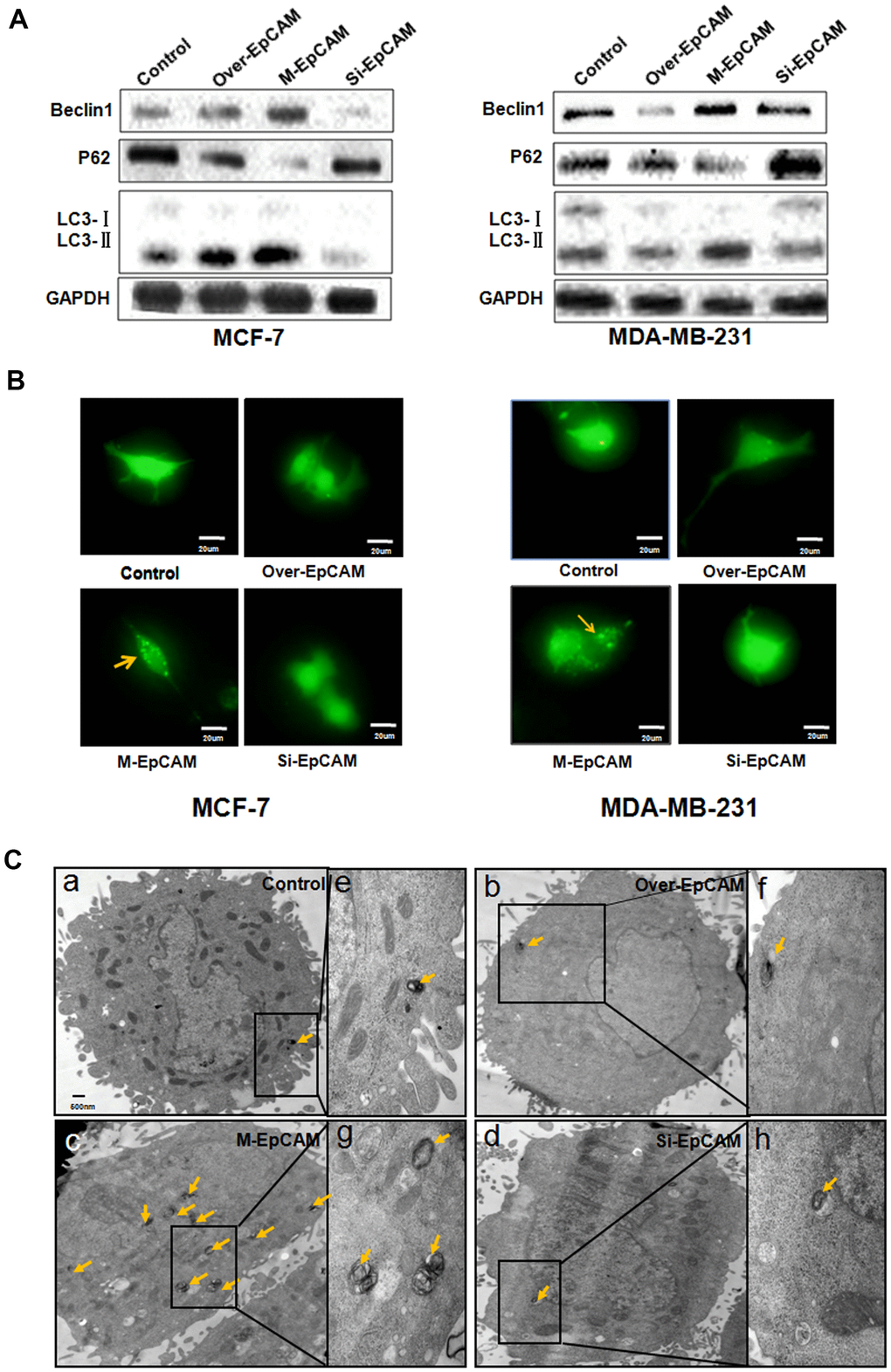Effect of EpCAM on autophagy. (A) MCF-7 cells and MDA-MB-231 cells were treated with pCMV-SPORT 6-EpCAM plasmid, si-EpCAM sequence and M-EpCAM plasmid for 48 hr. Whole cell lysates were subjected to western blot to detect the expression of Beclin 1, p62 and the conversion from LC3-I to LC3-II. (B) MCF-7 cells and MDA-MB-231 cells were transfected with pCMV-SPORT 6-EpCAM plasmid or si-EpCAM sequence or M-EpCAM plasmid and pGFP-LC3 plasmid for 48 hr, images were collected. After transfection for 24 hr, the cells were observed under an inverted microscope. Arrow depicted the autophagosome. (C) Representative transmission electron microscopy images depicting ultrastructures of MCF-7 cells which were transfected with pCMV-SPORT 6-EpCAM plasmid, si-EpCAM sequence and M-EpCAM plasmid, respectively. (e–h) depicted boxed sections in panels (a–d) at a higher magnification, respectively. Arrows indicate autolysosomes.