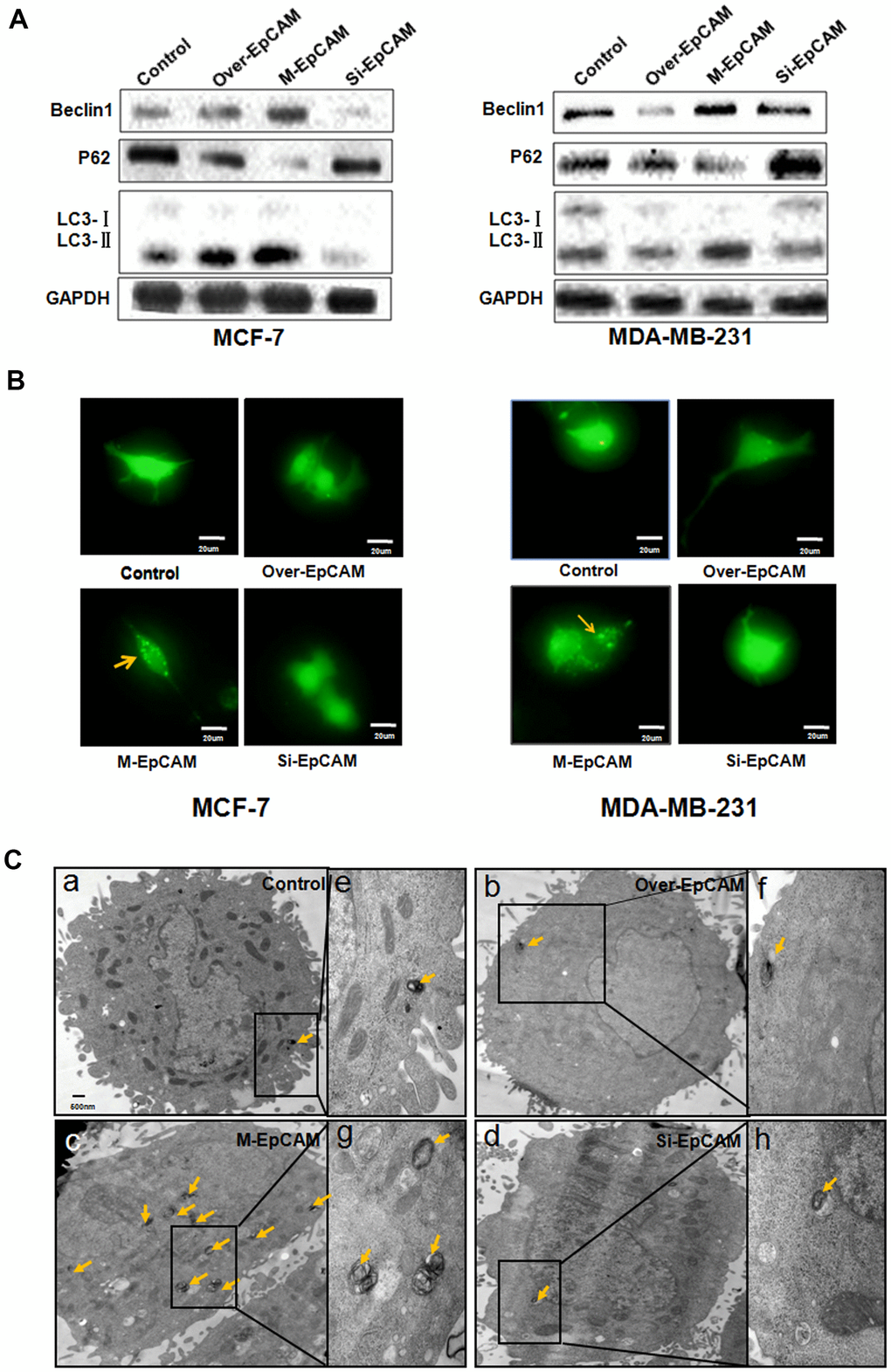 Pharmacological Inhibition of O-GlcNAcase Enhances Autophagy in