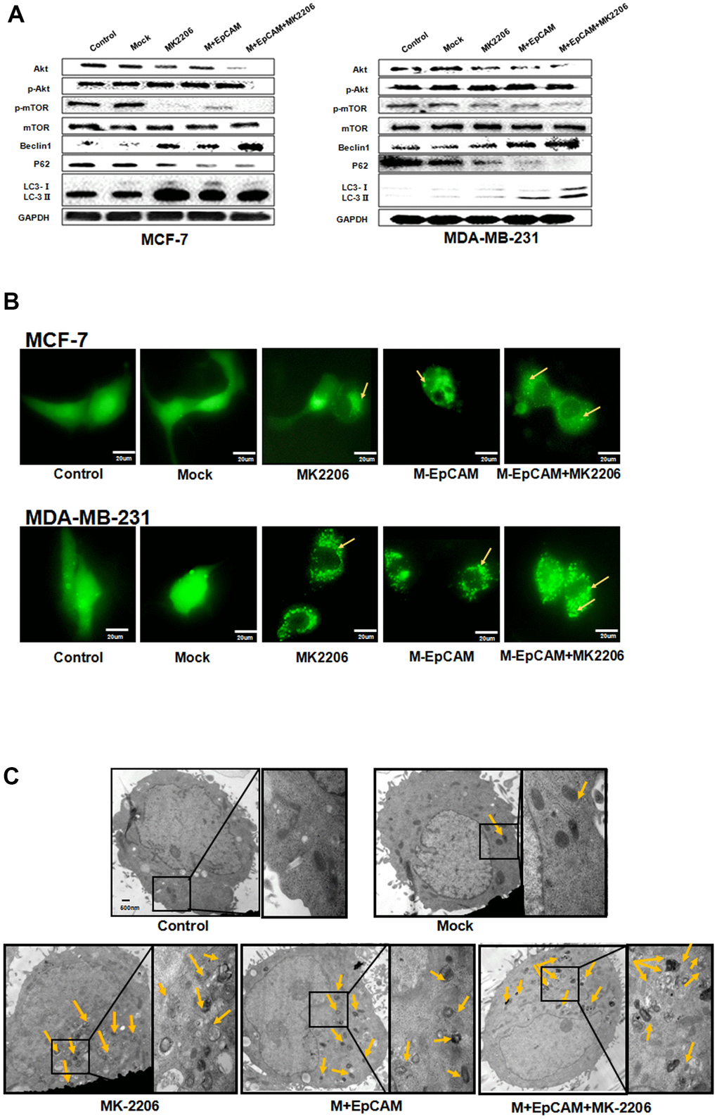 Effects of EpCAM on autophagy via PI3K/AKT/mTOR signaling pathway in MCF-7 and MDA-MB-231 cells. (A) MCF-7 cells and MDA-MB-231 cells were treated with M-EpCAM plasmid and MK2206 (1μM) for 48 h. Whole cell lysates were subjected to western blot to detect the expression of Beclin 1, p62 and the conversion from LC3-I to LC3-II. (B) MCF-7 cells and MDA-MB-231 cells were treated with M-EpCAM plasmid, pGFP-LC3 plasmid and MK2206 (1μM) for 48 hr. Cells were observed under an inverted microscope. Arrow depicted the autophagosome. (C) Representative transmission electron microscopy images depicting ultrastructures of MCF-7 cells which were transfected with M-EpCAM plasmid and MK2206 (1μM) for 48 h.