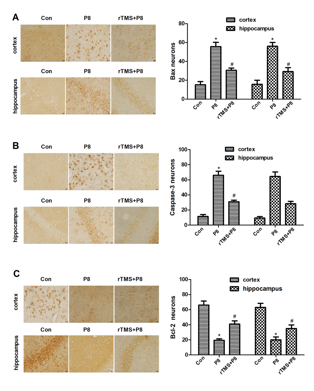 Changes in the expression levels of apoptosis-related proteins in cortical and hippocampal regions in the three groups after rTMS treatment. (A) Bax expression in the three groups was examined by immunohistochemistry staining and quantitative histogram analysis. (B) Caspase-3 expression in the three groups was examined by immunohistochemistry staining in three groups and quantitative histogram analysis. (C) Bcl-2 expression- in the three groups was examined by immunohistochemistry staining and quantitative histogram analysis. The data are presented as the mean ± standard deviation (n =5). *P 